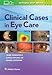 Clinical Cases in Eye Care