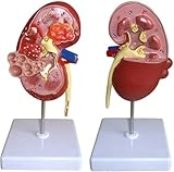 YOUFE Nierenbildungsmodell Funktionierendes Nierenmodell Mit 24 Digital Beschrifteten Und Anatomischen Positionsanweisungen Zur Demonstration Der Struktur Der Menschlichen Niere