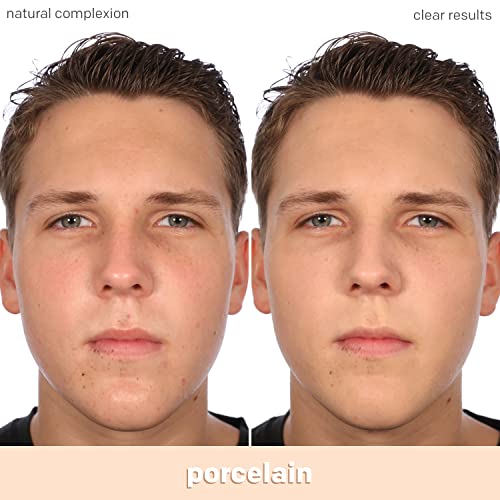 Almay Clear Complexion Acne Foundation Makeup With Salicylic Acid - Lightweight, Medium Coverage, Hypoallergenic, Fragrance-Free, For Sensitive Skin, 099 Porcelain, 1 Fl Oz. #TOP6