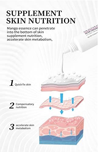 Easilydays Mango Repair Acne Cream, Face Pimple Removal Cream Acne Scar Treatment, Moisturize Skin, Fade Pockmarks Gently And Shrink Pores, For Acne Scar Removal, Spots, Balanced Water And Oil #TOP3