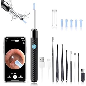 Ear Wax Removal – Earwax Remover Tool with 8 Pcs Ear Set – Ear Cleaner with Camera – Earwax Removal Kit with Light – Ear Camera with 6 Ear Spoon – Ear Cleaner for iOS & Android (Black)