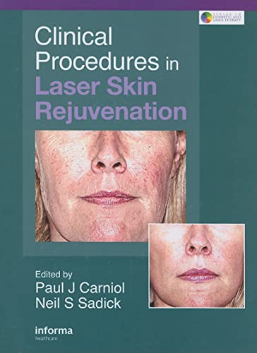 Clinical Procedures in Laser Skin Rejuvenation (Series in Cosmetic and Laser Therapy)