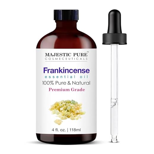 MAJESTIC PURE Frankincense Essential Oil, Therapeutic Grade, Pure and Natural Premium Quality Oil, 4 fl oz