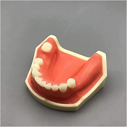 Modèle de pratique d'implant pour simuler la perte osseuse