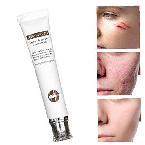 Littekenverwijdering Cream Acne Markeringen Remover Gel Skin Reparatie Burns Acne Spots Behandeling Optimale Restauratie… - Image 8