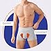 Hernia Belts for Men, Unilateral/Bilateral Inguinal Hernia Belt with 2 Removable Compression Pads for Pain Relief(Medium)