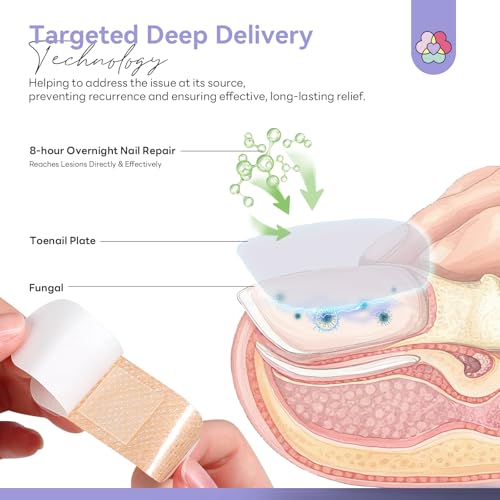 Image of SAVILAND Fungal Nail Patches 32 PCS FSA-HSA Extra Strength: 8H Overnight Repair 1% Tolnaftate Toenail Treatment Nighttime Nail Renewal Restores Damaged Nails Discolored Thick Yellow