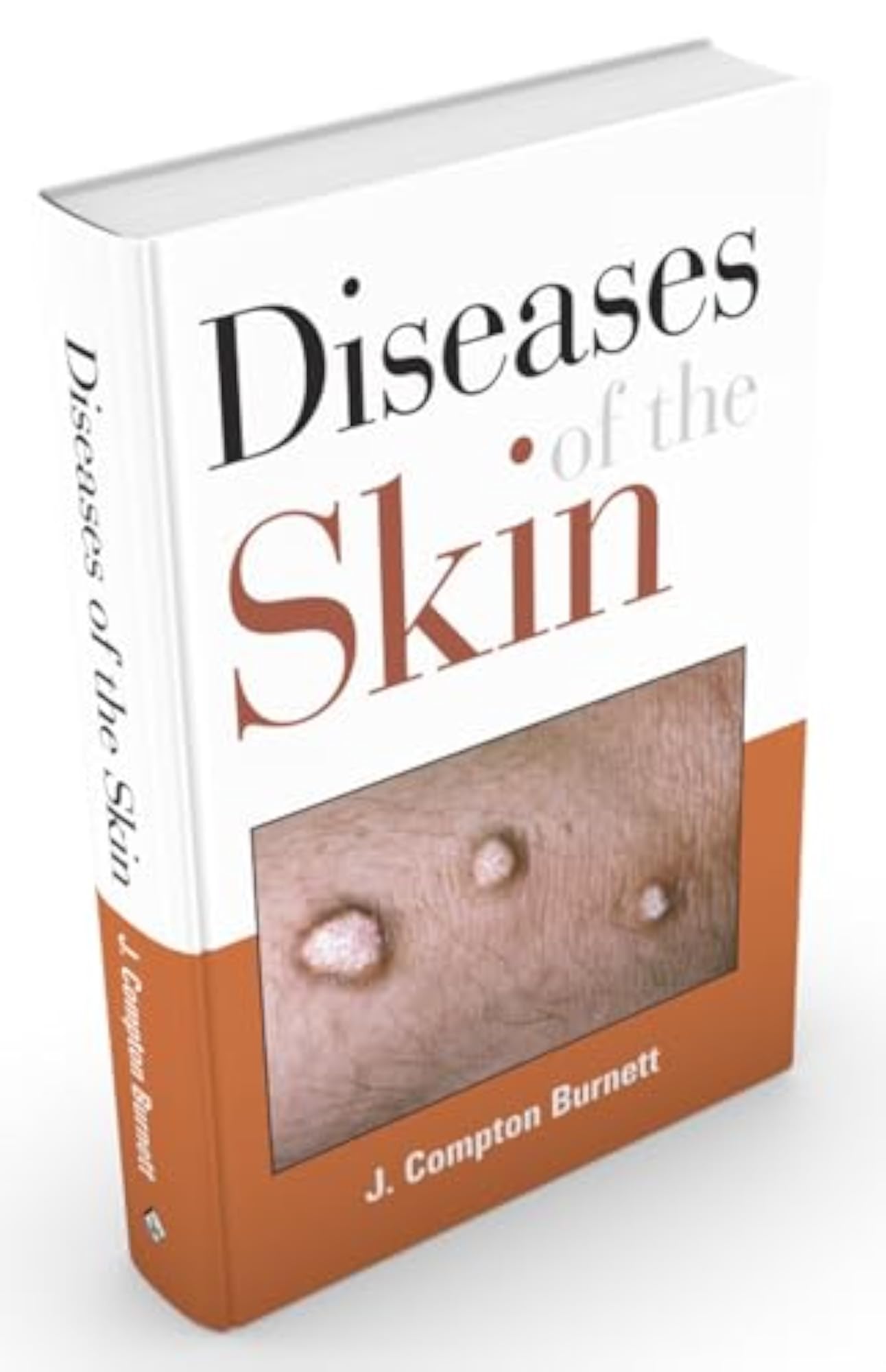 Diseases of the Skin their Constitutional Nature & Homeopathic Cure