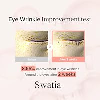 Revive Eye cream, Eye Serum with,Retinal Niacinamide Correction for Puffy Eye Bags Fine Lines,Dark Circles Wrinkles, Korean Skin Care 30ml 1Pcs — image 4