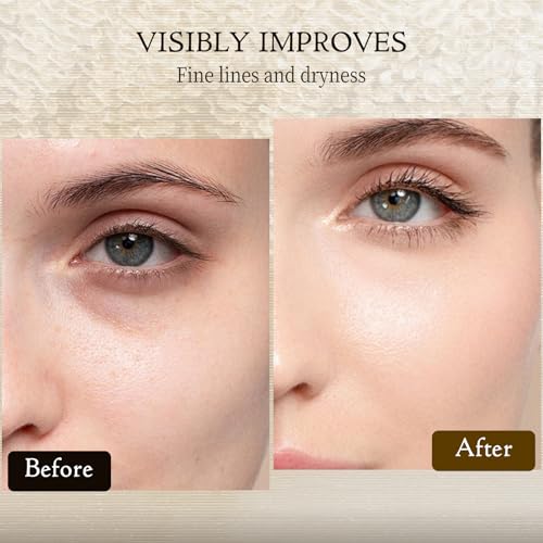 HOUGU Deerhorn Glue Eye Lotion, Hydrating Eye Cream for Smoother Looking Eyes, Moisturizes & Refreshes Delicate Eye Area Eye Moisturizing Lotion — view 6