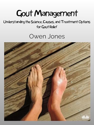 Gout Management: Understanding The Science, Causes, And Treatment Options For Gout Relief