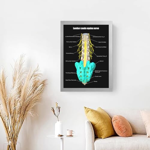 Image of Taanfu Body Educational Learning Anatomy Posters ，Equina Nerve Art Nerve Villi Anatomy Art Poster Digestive System Organs Illustration Small Intestine Physiology Anatomy Wall Art Villi