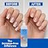 PRONAIL 100% Pure Acetone Nail Polish Remover, Professional-Grade Solvent for The 5-Minute Takedown of Acrylics & Gels, A Fast, Damage-Free Removal that Protects Nail Health - 16 Oz