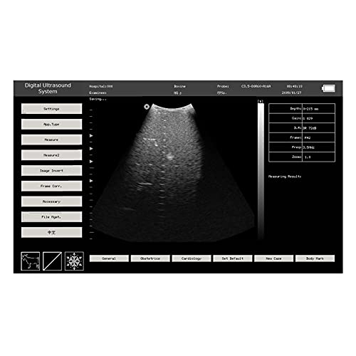 Contec Veterinary Portable Ultrasound Scanner For Pregnancy Check On Animals Horse Equine Goat Sheep Dog With 3.5Mhz Convex Probe thumb #3