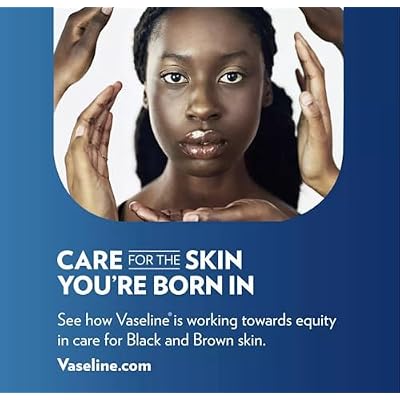 Vaseline Lip Therapy Original.25 oz (Pack of 12)