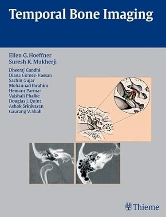 Temporal Bone Imaging Temporal Bone Imaging book cover