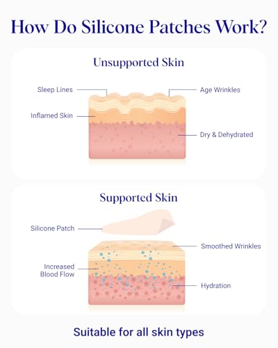 Wrinkles Schminkles Chest Wrinkle Patch - Reusable Silicone Smoothing Pads for Cleavage & Body, Reduce Wrinkles & Stretch Marks, Sensitive Formulated, Secret to Radiant Skin (1 Pack)