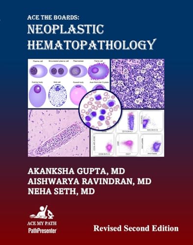 Ace The Boards: Neoplastic Hematopathology: Revised Second Edition (Ace My Path)