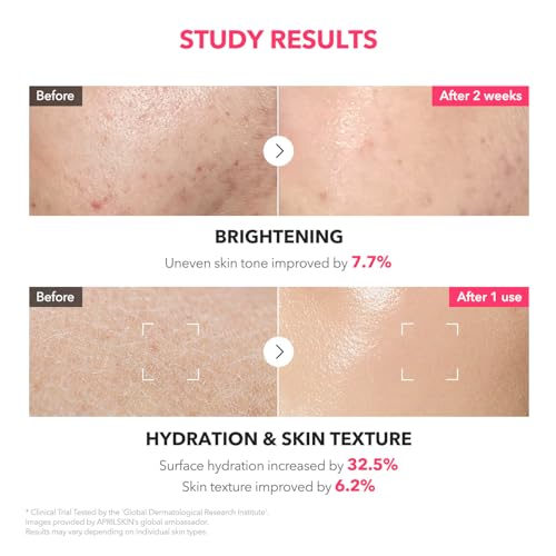 APRILSKIN TXA+Niacinamide 99 Pink Milky Toner | 99% High-Purity TXA 3%+ Niacinamide 5% for Brightening | Highly Concentrated Cream Toner | Deep Moisturizing Formula for Dull Skin | 5.07 fl.oz. - Thumbnail 5