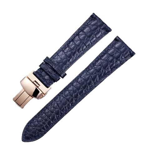 [] YingYou ʃNR_CU[XgbvAo^tCobNtA19mmA20mmA21mmA22mm̃Y^XgbvA\tguXbg(Blue-rose gold,12mm)