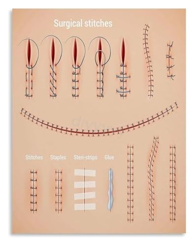 Basic Surgical Suture Poster Medical Training Art | Emergency Stitching Diagram for Lab Wall Decor(Magnetic,08x12inch(20x30cm))