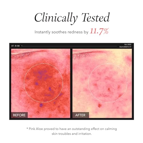 APRILSKIN Pink Aloe Facial Polish Cleanser | Gentle Exfoliation with Mungbean & Soybean Scrub | Removes Waterproof Makeup & Sunscreen | Non-Comedogenic Cleanser for All Skin Types | Korean Skincare - Image 5