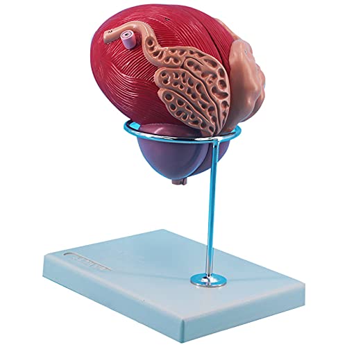 Preisvergleich Produktbild YZILXY Menschliches Blasenmodell, Prostatamodell, Anatomisches Modell des Urogenitalsystems, 3-Fach Vergrößert Für Den Urogenitalunterricht Und Die Kommunikation Zwischen Arzt Und Patient