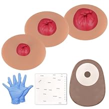Sticky Colostomy Simulators, Stoma Training Model Set, Multi-Skin Tone Ostomy Care Practice Models for Medical Training and Patient Education- Tan