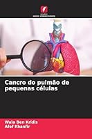 Cancro do pulmão de pequenas células (Portuguese Edition) 6209505538 Book Cover