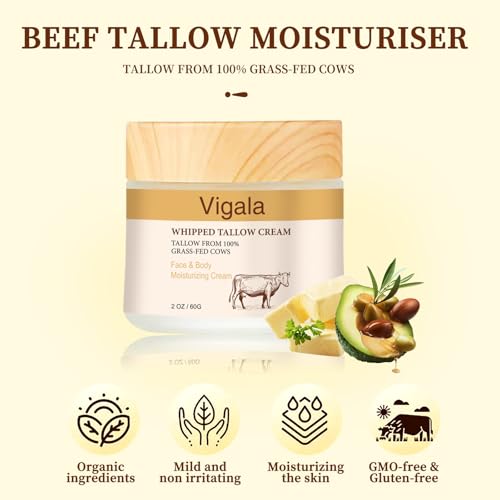 Vigala Deeply Nourishing Whipped Tallow Face & Body Cream, Grass Fed Soft Beef Tallow Balm with Shea Butter Moisturizer Soothing Face Cream for Skin Care-2 oz