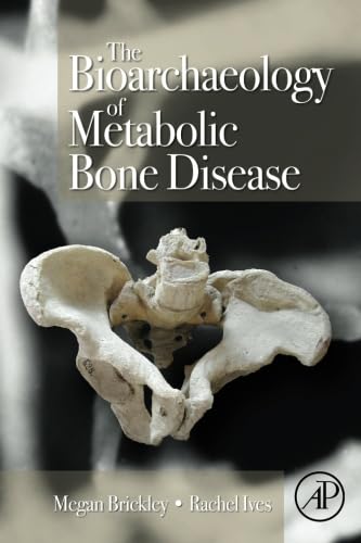 The Bioarchaeology of Metabolic Bone Disease