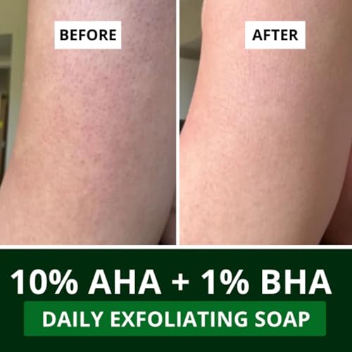 Image of BAKE 10% AHA + 1% BHA Scrub Treatment Soap with Lactic Acid, Glycolic Acid, 1% Salicylic Acid | For Clogged Pores, Exfoliation, Strawberry Skin & Bright Underarms | Soap for Women & Men | 100g x 4 (Pack of 4)