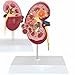 Produktbild HUIGE Pathologisches Nierenanatomisches Modell, Lebensgroßes Menschliches Nierenmodell Nierenerkrankungsmodell Menschliches Organ Medizin Anatomie Lehren Lernmaterialien