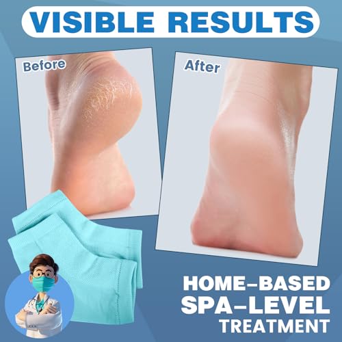 Image of TEAWOO 6 Pairs Blue Moisturizing Heel Socks for Cracked Heel Treatment