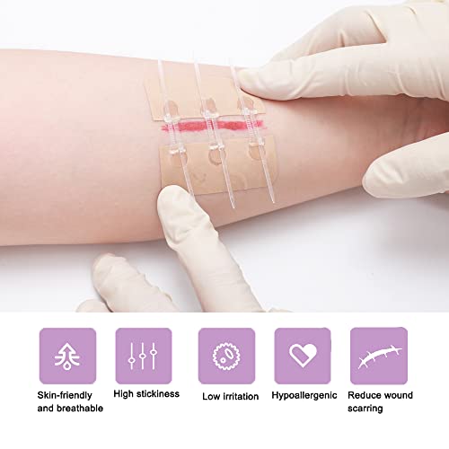 Longmed Emergency Waterproof Wound Closure Strips Butterfly Bandages Stitch Sutures Adhesive Bandages For First Aid Zipper Laceration Repair Without Stitches For Wound Care #TOP1
