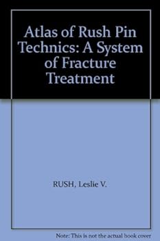 Atlas of Rush Pin Technics: A System of Fracture Treatment