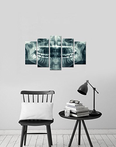 Ihappywall Modern 5 Panel Canvas Wall Art X-Ray Dental Tooth Oral Panoramic The Picture Teeth Decay Print For Dental Room Stretched And Framed For Living Room Ready To Hang #TOP2