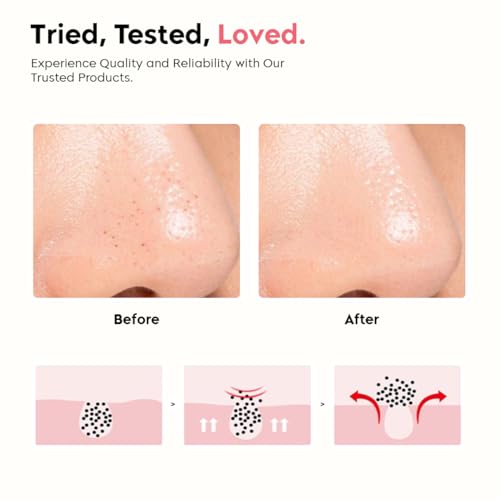 Image of Gleva Silicon Face Cleansing Brush - Soft & Thin Silicone Bristles for Gentle Exfoliation - Multipurpose Silicone Brush Face Scrubber for Deep Cleansing & Blackhead Removal (Assorted)