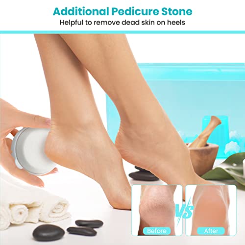 Image of Giantex Foot Spa with Heat and Massage - Feet Bath Soak Tub w /Bubble, Vibration, Removable Pedicure Stone, Massage Beads, Auto Shut-Off, Relieve Feet Stress, Pedicure Foot Soaker Tub (Turquoise)
