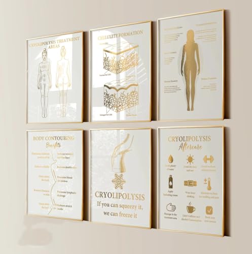 NATVVA Body Sculpting Posters Cryolipolysis Wall Art