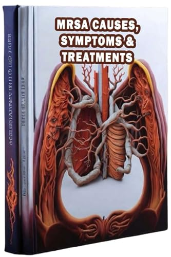 MRSA Causes, Symptoms & Treatments: Get informed about MRSA, its origins, symptoms, and available treatment options to combat this antibiotic-resistant infection.