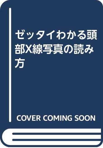 無料電子書籍 pdf ゼッタイわかる頭部X線写真の読み方 バイ