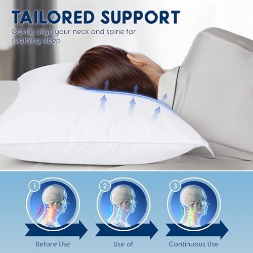 LIANLAM Luxury Canadian White Goose Down Pillow - 900+ Fill Power, 800 Thread Count Cotton Shell, Soft Down Pillows for Sleeping, Hotel Collection Pillow for Neck Pain Relief (2 Pack,Queen(20