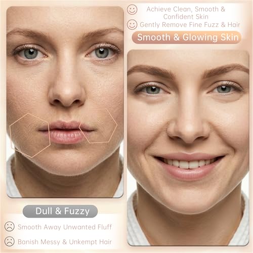 Bkwity Sonic Dermaplane Razor for Women Facial Hair & Peach Fuzz Remover — view 6
