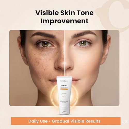 Image of Charwee Dark Spot Remover Face Wash Scrub Gel Cleanser - 100ml | With Kojic and Hyaluronic Acid | Soothing Aloe Vera | Removes Dark Sports and Helps Brighten Skin