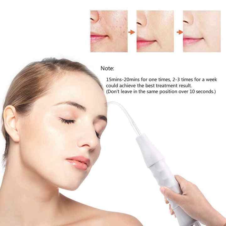 SDERMATECH Portable High Frequency Facial Machine for Acne Pimples Skin Treatment - Image 3