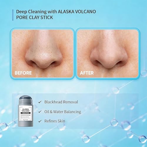 Generic Clay Mask Stick, Alaska Volcano Pore Clay Stick, Smoothing Skin, Non-Drying, Oil Control For All Skin Types (2PCS Gray Clay Mask for Pores)