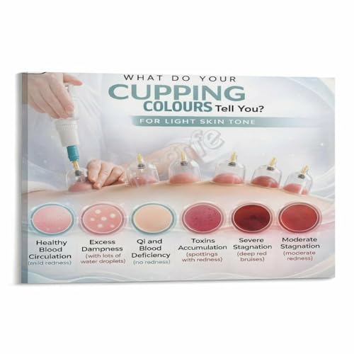What Do Your Cupping Color Tell You Infographic Poster Cupping