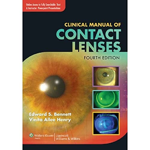 Clinical Manual of Contact Lenses