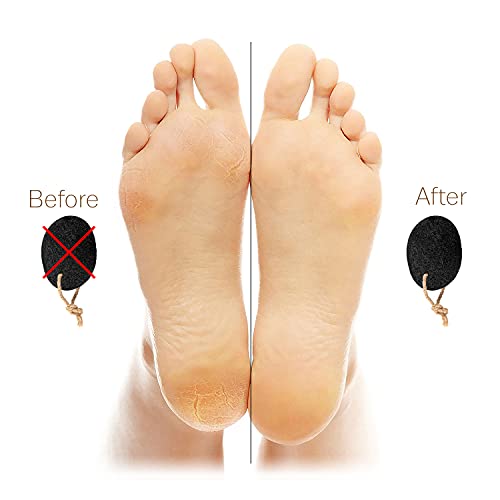 image for Pumice Valley Pumice Stones for Feet - Natural Earth Lava Black Pack o